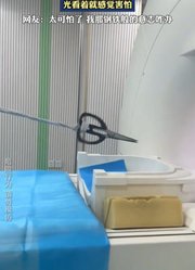 男子演示做核磁共振带金属的后果，光看着就感觉害怕。