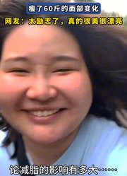 女子从184斤到120斤，瘦了60斤的面部变化