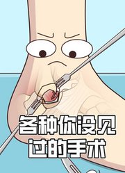 各种你没见过的手术